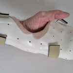 Sponges, Stiches and Splints