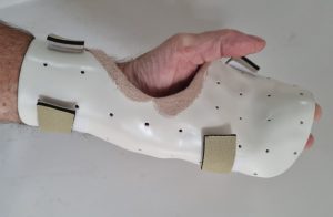 Sponges, Stiches and Splints