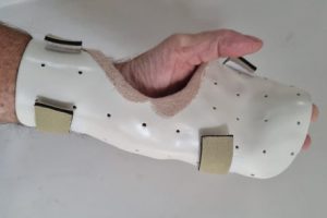 Sponges, Stiches and Splints