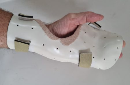 You are currently viewing Sponges, Stiches and Splints