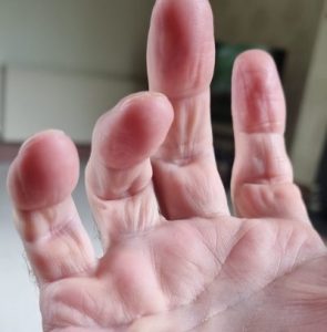 The Viking Fist: an introduction